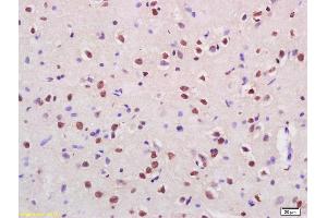 Formalin-fixed and paraffin embedded rat brain labeled with Rabbit Anti Cux2 Polyclonal Antibody, Unconjugated (ABIN1386279) at 1:200 followed by conjugation to the secondary antibody and DAB staining (CUX2 抗体  (AA 1001-1085))