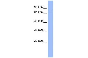 WB Suggested Anti-GPD2 Antibody Titration:  0. (GPD2 抗体  (N-Term))