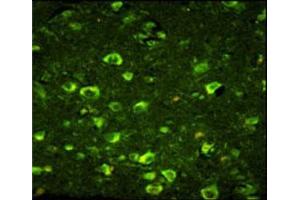 Immunofluorescence analysis of ABI1 antibody with paraffin-embedded human brain tissue. (ABI1 抗体  (AA 81-108))