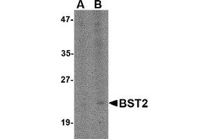 Western Blotting (WB) image for anti-Bone Marrow Stromal Cell Antigen 2 (BST2) (N-Term) antibody (ABIN1031283) (BST2 抗体  (N-Term))