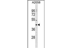 Western blot analysis in A2058 cell line lysates (35ug/lane). (DNAJC25 抗体  (AA 211-239))