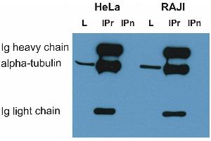 Immunoprecipitation (IP) image for anti-alpha Tubulin (TUBA1) antibody (ABIN93891)