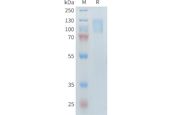 PLA2R1 Protein (AA 21-521, AA 1097-1246) (His tag)