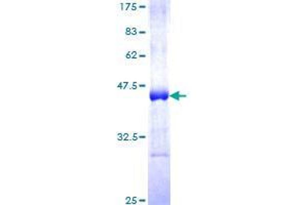 CARD14 Protein (AA 905-1004) (GST tag)