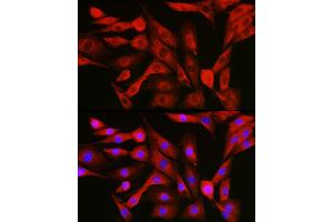 Immunofluorescence (IF) image for anti-Nuclear Factor of kappa Light Polypeptide Gene Enhancer in B-Cells 1 (NFKB1) (AA 740-964) antibody (ABIN6144571)