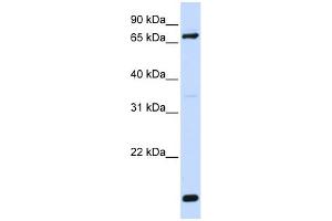 WB Suggested Anti-ACSL4 Antibody Titration: 0. (ACSL4 抗体  (N-Term))