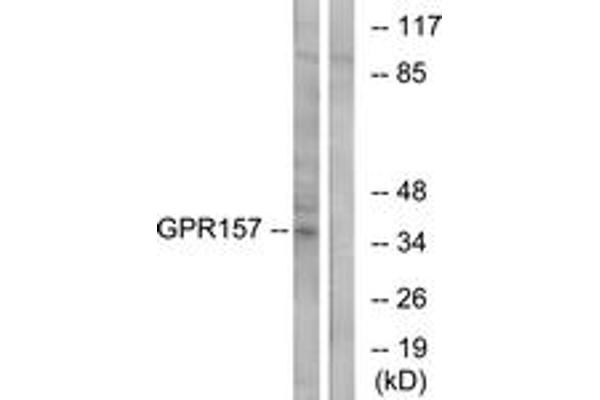 GPR157 抗体  (AA 81-130)