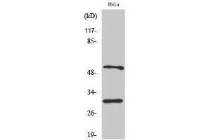 Western Blotting (WB) image for anti-Caspase 10 B/C antibody (ABIN5956727) (Caspase 10 B/C 抗体)