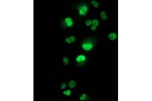 Anti-TP53 mouse monoclonal antibody (ABIN2454551) immunofluorescent staining of COS7 cells transiently transfected by pCMV6-ENTRY TP53 (RC200003). (p53 抗体)