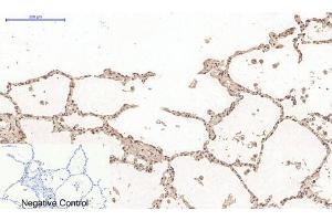 Immunohistochemistry (IHC) image for anti-Desmin (DES) antibody (ABIN5958489) (Desmin 抗体)