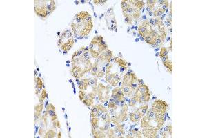 Immunohistochemistry of paraffin-embedded human gastric using GLS antibody at dilution of 1:100 (x40 lens). (Glutaminase 抗体)