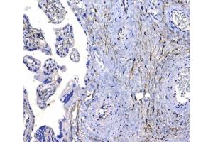 IHC testing of FFPE human placental tissue with CD44 antibody at 1ug/ml. (CD44 抗体)