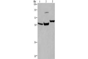 Western Blotting (WB) image for anti-Estrogen Receptor 1 (ESR1) antibody (ABIN2430023) (Estrogen Receptor alpha 抗体)