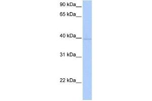 ZNF385D antibody used at 0. (ZNF385D 抗体  (C-Term))