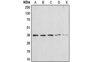 Western blot analysis of Annexin A1 expression in HEK293T (A), NIH3T3 (B), THP1 (C), Molt4 (D), HepG2 (E) whole cell lysates. (Annexin a1 抗体  (Center))