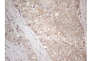 Immunohistochemistry (IHC) image for anti-Insulin-Like Growth Factor Binding Protein 1 (IGFBPI) (AA 26-259) antibody (ABIN2676854) (IGFBPI 抗体  (AA 26-259))