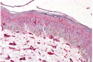 Human Skin (formalin-fixed, paraffin-embedded) stained with VIM antibody ABIN239818 at 5 ug/ml followed by biotinylated anti-mouse IgG secondary antibody ABIN481714, alkaline phosphatase-streptavidin and chromogen. (Vimentin 抗体)