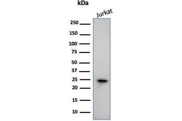 CD3 epsilon 抗体  (Cytoplasmic Domain)