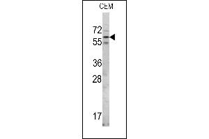 Western blot analysis of RIOK2 Center (ABIN390991 and ABIN2841174) in CEM cell line lysates (35 μg/lane). (RIOK2 抗体  (AA 270-299))
