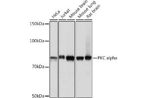 Western blot analysis of extracts of various cell lines, using PKC alpha pAb (ABIN6128460, ABIN6135858, ABIN6135859 and ABIN7101370) at 1:1000 dilution. (PKC alpha 抗体)