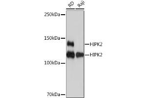 Western blot analysis of extracts of various cell lines, using HIPK2 Rabbit mAb (ABIN7267779) at 1:1000 dilution. (HIPK2 抗体)