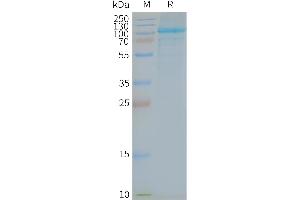 Human -Nanodisc, Flag Tag on SDS-PAGE (TLR5 蛋白)