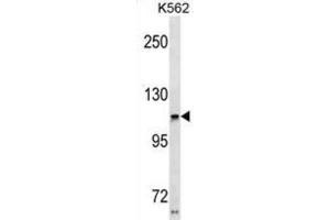 Western Blotting (WB) image for anti-Usher Syndrome 1C (Autosomal Recessive, Severe) (USH1C) antibody (ABIN3001013) (USH1C 抗体)