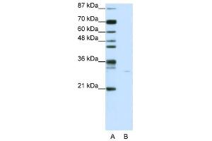 PDCD8 antibody used at 0. (AIF 抗体  (C-Term))