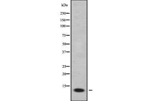 Western blot analysis of ACBD7 using K562 whole cell lysates (ACBD7 抗体  (Internal Region))