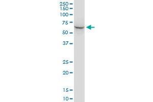 Western Blotting (WB) image for anti-Stress-Induced-phosphoprotein 1 (STIP1) (AA 1-543) antibody (ABIN524365)