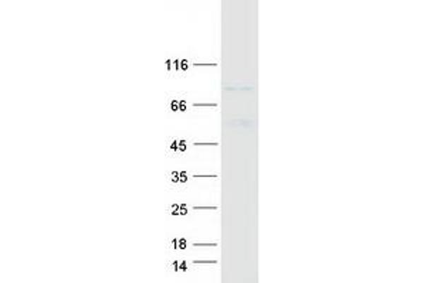 NDUFS1 Protein (Myc-DYKDDDDK Tag)