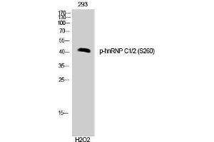 Western Blotting (WB) image for anti-Heterogeneous Nuclear Ribonucleoprotein C (C1/C2) (HNRNPC) (pSer260) antibody (ABIN3173285) (HNRNPC 抗体  (pSer260))
