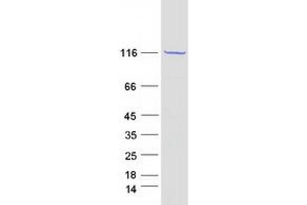 PC Protein (Transcript Variant 1) (Myc-DYKDDDDK Tag)