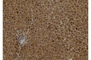 ABIN6278237 at 1/100 staining Rat liver tissue by IHC-P. (S100A2 抗体)
