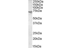 Western Blotting (WB) image for anti-Acetylcholinesterase (AChE) (C-Term) antibody (ABIN2465345) (Acetylcholinesterase 抗体  (C-Term))