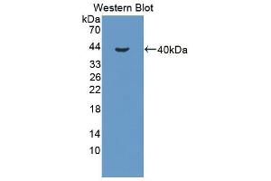 Figure. (PDLIM1 抗体  (AA 2-329))