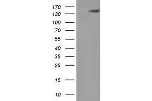 HEK293T cells were transfected with the pCMV6-ENTRY control (Left lane) or pCMV6-ENTRY HDAC6 (Right lane) cDNA for 48 hrs and lysed. (HDAC6 抗体)