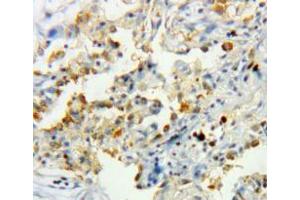 Used in DAB staining on fromalin fixed paraffin-embedded lung tissue (Catalase 抗体  (AA 10-507))