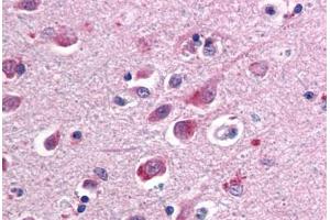 Human Brain, Cortex (formalin-fixed, paraffin-embedded) stained with SARM1 antibody ABIN461750 at 10 ug/ml followed by biotinylated anti-mouse IgG secondary antibody ABIN481714, alkaline phosphatase-streptavidin and chromogen. (SARM1 抗体  (AA 93-292))