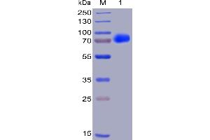 Human CS1, hFc-His Tag on SDS-PAGE under reducing condition. (Catalase Protein (CAT) (AA 23-226) (His tag,Fc Tag))