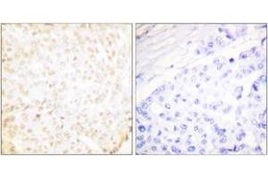 Immunohistochemistry (IHC) image for anti-X-Ray Repair Complementing Defective Repair in Chinese Hamster Cells 5 (Double-Strand-Break Rejoining) (XRCC5) (AA 683-732) antibody (ABIN2889296) (XRCC5 抗体  (AA 683-732))