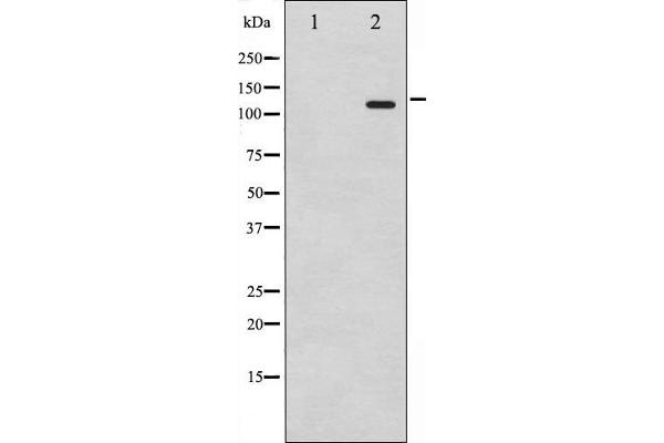 Retinoblastoma 1 抗体  (pSer795)