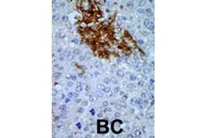 Immunohistochemistry (IHC) image for anti-Pregnancy Up-Regulated Non-Ubiquitously Expressed CaM Kinase (PNCK) antibody (ABIN3002987) (PNCK 抗体)