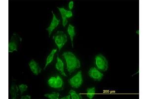 Immunofluorescence of monoclonal antibody to TIMP2 on HeLa cell. (TIMP2 抗体  (AA 27-220))