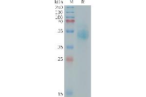 Human (544-643) Protein, mFc Tag on SDS-PAGE under reducing condition. (ERBB3 Protein (AA 544-643) (mFc Tag))