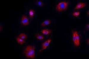 Immunofluorescence (IF) image for anti-Cadherin 5 (CDH5) antibody (Alexa Fluor 594) (ABIN2656818) (Cadherin 5 抗体  (Alexa Fluor 594))