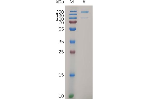 ITGA2 Protein (AA 30-1132) (His tag)