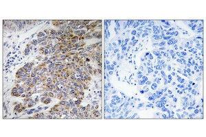 Immunohistochemistry (IHC) image for anti-Carbohydrate Sulfotransferase 10 (CHST10) (Internal Region) antibody (ABIN1850990) (CHST10 抗体  (Internal Region))