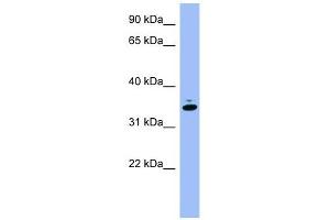 GAPDH antibody used at 1 ug/ml to detect target protein. (GAPDH 抗体  (Middle Region))