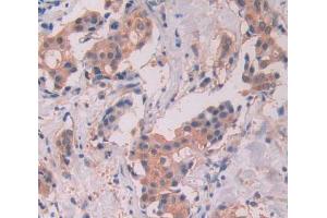 Used in DAB staining on fromalin fixed paraffin- embedded Kidney tissue (STAT5A 抗体  (AA 586-688))